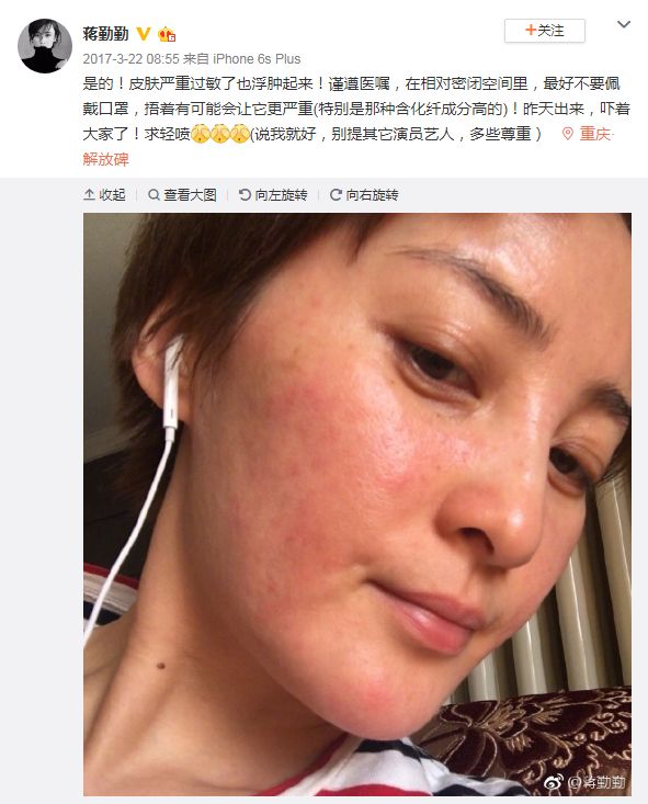 曾让舒淇"息影"的换季过敏肌很难搞?可能是你的护肤方式出了错!